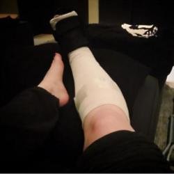 Kelly Osbourne's foot (c) Instagram