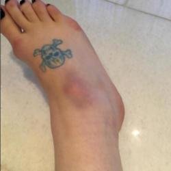 Kelly Osbourne's fractured foot (c) Instagram