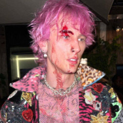 Machine Gun Kelly says he was left bloodied by a champagne flute after trying to clink it in a toast