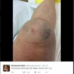 Roseanne's broken knee (c) Twitter