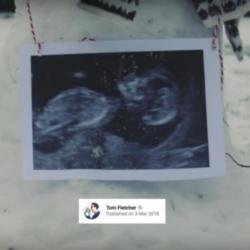 Tom and Giovanna's baby announcement
