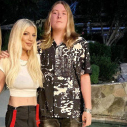 Tori Spelling's teenage son Liam had to have surgery on his foot