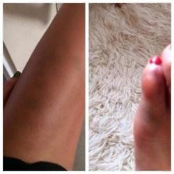 Una Foden suffers broken toe (c) Instagram