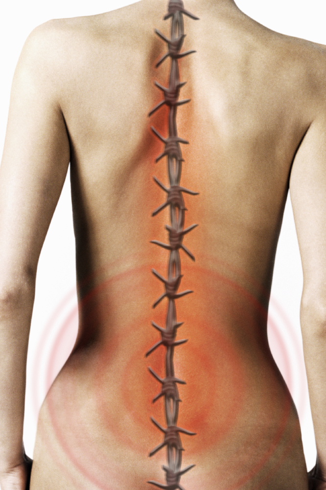Are you taking advice on your back pain?