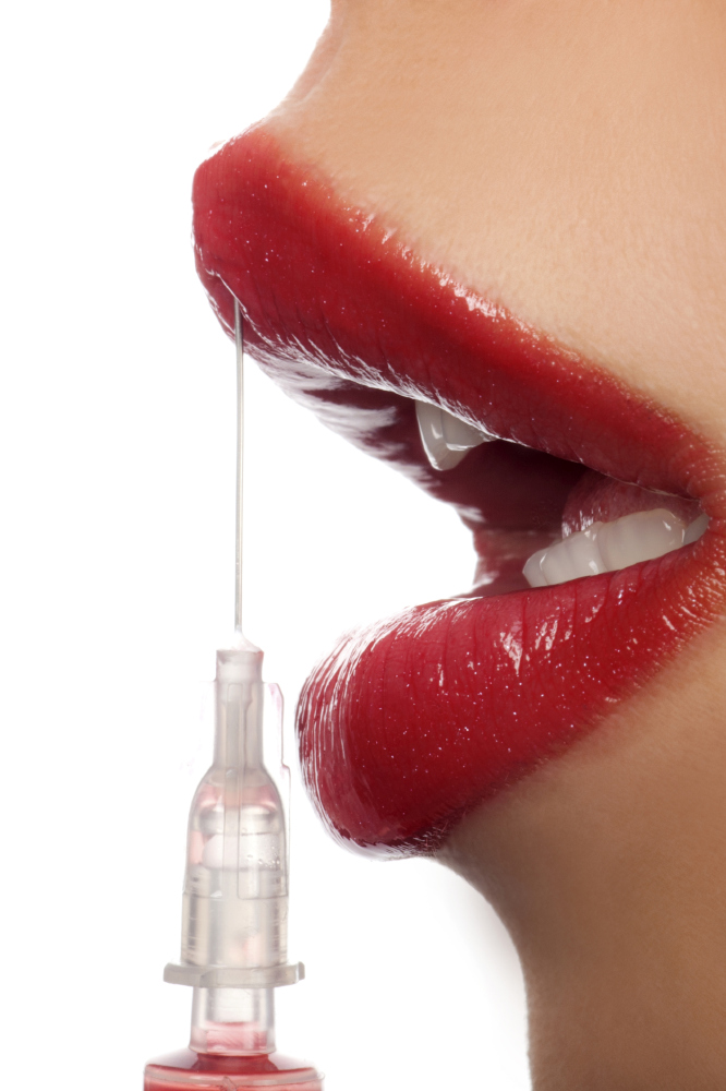Read these essential rules before you get lip fillers