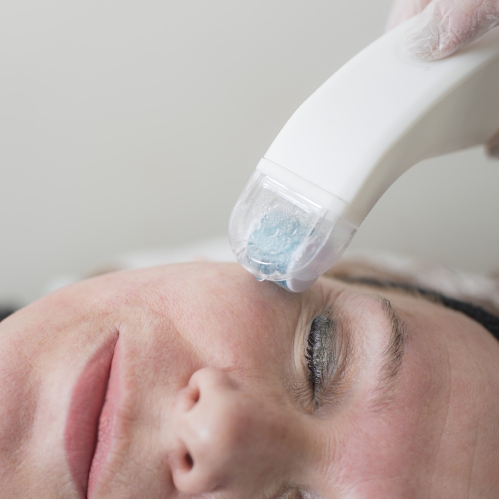 Give your skin a lift with the Crystal Clear COMCIT treatment