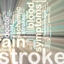 Do you know how you can prevent a stroke?